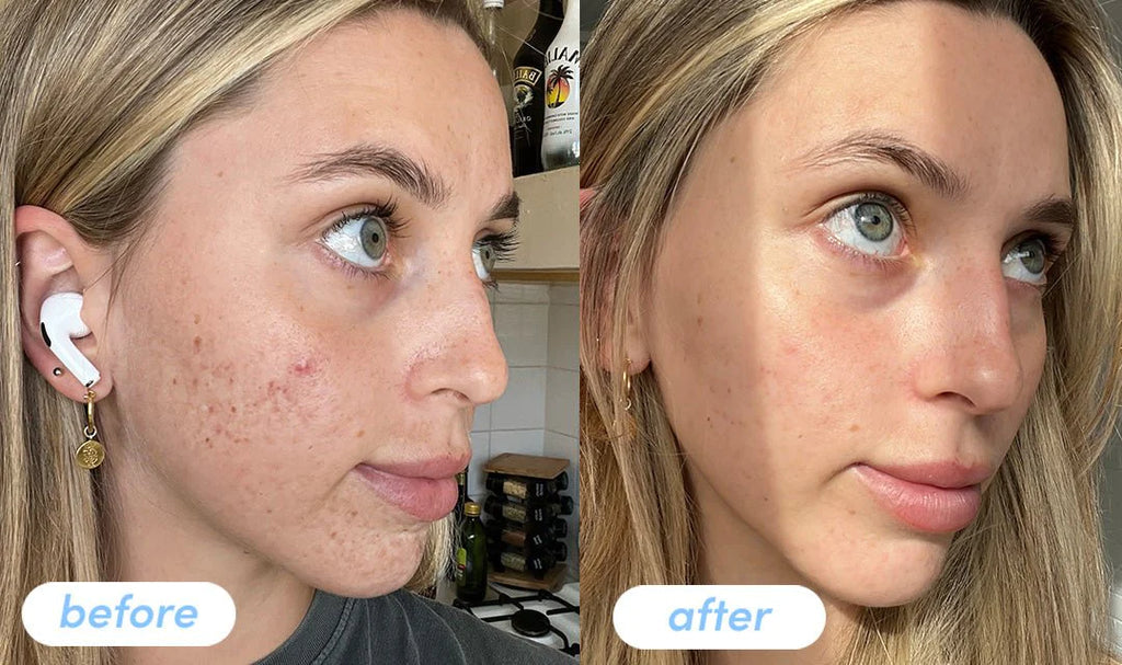 Close-up of skin before and after using collagen soap, showing smoother, healthier appearance.